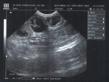 Ultraschall Jaris 11. Dezember 2009